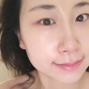 강동-천호-308 | 천호피부관리 제이라운지에스테틱 천호점 추천