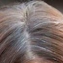 교정요가(A) 이미지