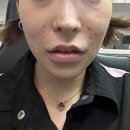 리즈벨의원 네이버블로그