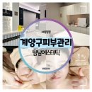 덕용프라자 | 계양구 피부관리 :: 탐날에스테틱에서 작은얼굴 파워트리 윤곽관리 리얼후기
