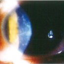 대연본안과의원 이미지