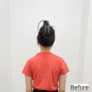 에스엔피이바른자세척추운동분당 | PHS척추 & 재활전문센터 판교점_ 눈에 보이는 Before & After
