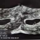 도안누리여성의원 이미지