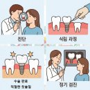 서울강남플란트치과의원 | 제천임플란트 서울강남플란트치과 안전하게 준비하기