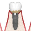 똑디치과의원 이미지