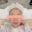 수가인 | 처인구피부관리 수가인뷰티 용인둔전점 물방울초음파 리프팅 후기