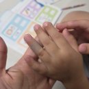 이노 | 육아템추천 의료용 실리콘테이프 이노테이프 사용 후기