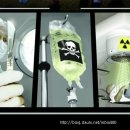 암 환자의 방사선 치료 후유증을 완화시키는 방법 (디톡스 요법) 이미지