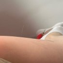 경희자란한의원 | [블챌2] 허리디스크 한방치료 병행 경희자란한의원 후기