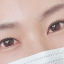 테라스 인 스킨 이미지