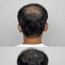 엔진미용실 이미지