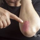 동아헬스 이미지