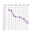 다비치히어링 대구서부정류장점 이미지