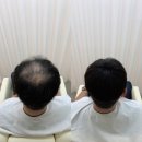 헤어 인 에드