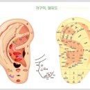 이혈요법 이미지