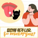 강동성모내과의원 | 강동류마내과의원에서 알아보는 류마티스 및 통풍 질환 정보