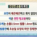 [건강] 손톱 상태로 알아보는 내 건강 이미지