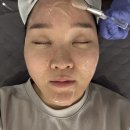 구마로 | 여름휴가로 칙칙해진 피부 탈출! 달서구 피부관리실 리더스킨에서 피부관리 받은 후기