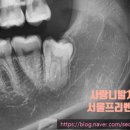 서울프리벤치과의원 이미지