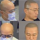 한천 | 천안두피디자인아카데미에서 배우는 두피 관리 노하우와 중요성