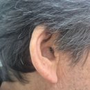 하나히어링보청기 동대문센터 이미지