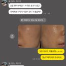 진주사 | 합정피부과 자가 줄기세포 뱀파이어 주사로 5살 어려진 후기