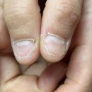 LCN라운지 목포점 손톱치장 | 압구정네일샵 물어뜯는손톱 전문 케어 LCN라운지 강남압구정점 이홍진뷰티