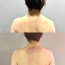 은가비 피부관리실 | 대구 달서구 월성동 등관리 잘하는 은가비 피부관리실 재방문 후기 !