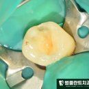 범플란트치과의원