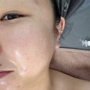 리라헬스케어 | 피부관리/신장동피부관리 아라뷰티케어에서 물광필 받고 푸석한 피부 탈출! (리라신 애씨큘필링 관리후기)