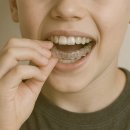 고덕아이온소아치과치과의원 | 평택 고덕 치과 소아교정 시기, 1차교정과 투명교정 총정리