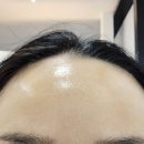 로이뷰티 | 수유역피부관리, 로이뷰티 시바산발삼키트 민감피부 후기