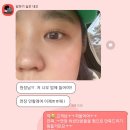 블링you