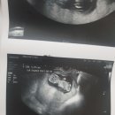 아마존여성의원 이미지