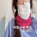 인제대학교해운대백병원 | 부산 해운대 백병원 비염수술 후기 내돈내산