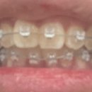 맛있는칭구들 이미지