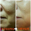 [공지] “피부과 안 가도 된다?” 요즘 난리 난 올인원 앰플