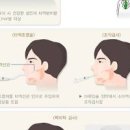 입안이 마르는 이유 뭘까? 입마름 증상 원인 8가지 구강건조증 이미지