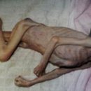 `김목사`가 저지른 ......뼈만 앙상…보육원서 방치돼 숨진 아이 이미지