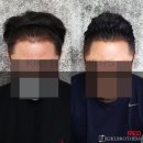 키키브라더스 이미지