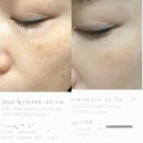 신경우 | 기미 피부 셀러가 써본 설화수 자정 앰플세럼 자정 기미 코렉터 미백관리 후기