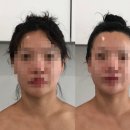 광주 윤곽관리 오월에스테틱 JH윤곽술 후기