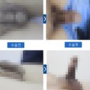 유로센터비뇨기과의원 | 발기부전비뇨기과, '이런 곳'은 거르시기 바랍니다