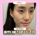 둔촌 피부관리 추천 예쁘다에스테틱 둔촌점 모공관리 후기