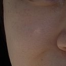 바른메디컬 이미지