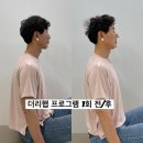 버섯목 거북목 두통과 목통증이 고민-포항 필라테스 실제 후기로 알아보기