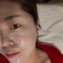 루비 | 압구정 피부과 루비레이저 내돈내산 후기 가격 효과