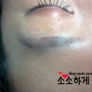 핑크핑거(pink finger) 이미지