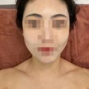 빛나는너의하루 | 야탑 피부관리 빛나는 지금 솔직 후기 | 순환관리 받자마자 눈에 띄게 달라진 피부 리프팅 효과