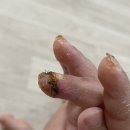 부산마이크로병원 이미지